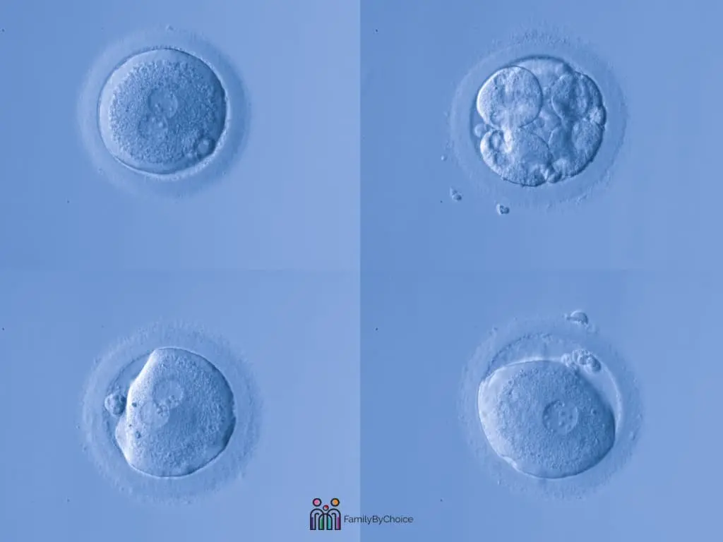 human eggs before freezing