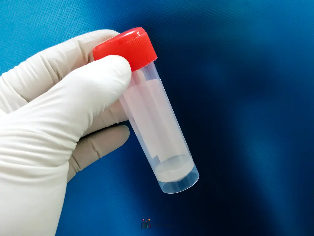sperm count sample